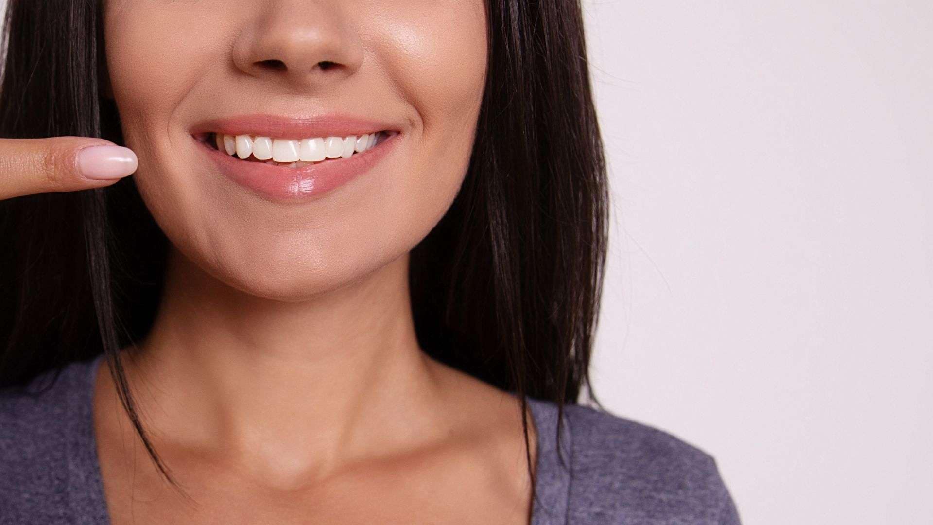 How often teeth whitening
